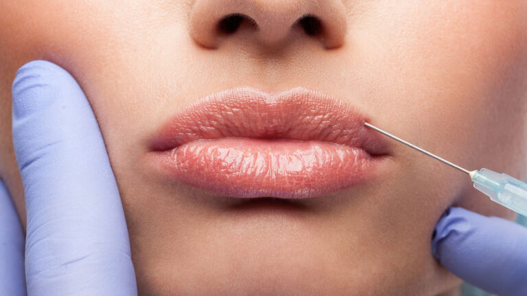 Enhance Your Smile with Lip Fillers in Plano, Texas